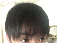 高校2年生の男です。この前髪は薄いですか？普通ですか？ 