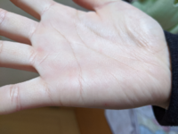 最近 小指側の結婚線が伸びてきた気がします どのようなことが起こ Yahoo 知恵袋
