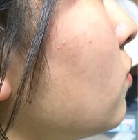 体の垢が落ちません 牛乳石鹸を泡だて 肌が荒れたく無いので 手で体を洗っ Yahoo 知恵袋