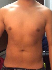 これは女性化乳房ですか 筋トレをしているのですが 胸が Yahoo 知恵袋