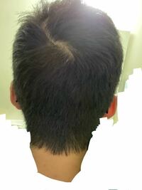 4月から大学生になります 後頭部から見たら 髪の分け目が写真 Yahoo 知恵袋