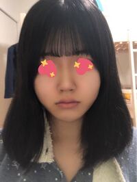 芸能人は鼻のプロテーゼよりもヒアルロン酸で鼻高くしてる人の方が多いですか Yahoo 知恵袋