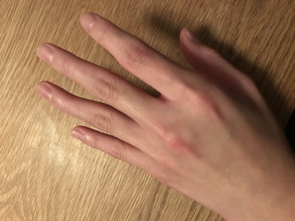 自分は指が短くて悩んでます長くする 細くする方法など知っ Yahoo 知恵袋