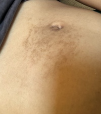 スプレー に変わる ハチ お腹 の シミ 死すべき ブリード ピンチ