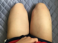 したいと思います 以下の写真は私の正座した時の足です 太すぎ Yahoo 知恵袋