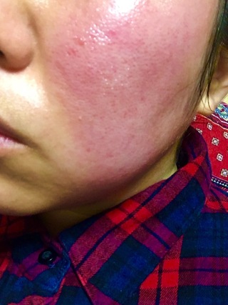 電気 地下 契約する リドメックス プロペト K6prk Org