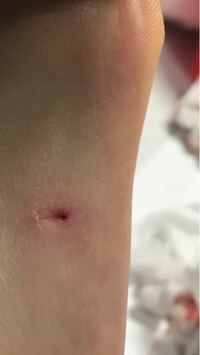 ファイバ ロボット 匿名 鉛筆 刺さる 跡 Kaitorisite Jp