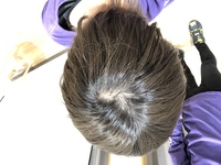 つむじが広い気がするのですがこれってまずいですか 昔から広いと言われて Yahoo 知恵袋