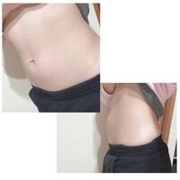 高校生になって一年が過ぎた女子です お腹がポッコリとしてきたのが気にな Yahoo 知恵袋