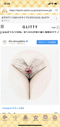 陰毛を剃ったあとにここ 写真 が痒くなります質問したら毎回 パンツとの Yahoo 知恵袋