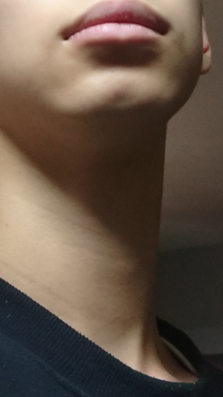 これってケツアゴですか Yahoo 知恵袋