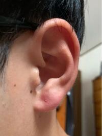 約2ヶ月前に塞がってしまったピアスホールなのですが この程度 Yahoo 知恵袋