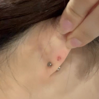 ピアスの裏側だけこのように赤くなってしまっているのは何故でし Yahoo 知恵袋