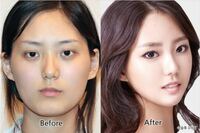韓国では顎が尖っていて 顔の横幅がせまい人が多いですよね それはフェイ Yahoo 知恵袋