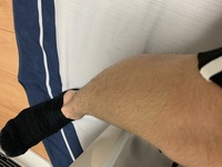 男子高校生です すね毛濃いですよね なんかくるくるなので サラサラにす Yahoo 知恵袋