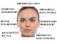 顔の歪み 噛みグセは左右どっち 顔が左右 少しずつズレて歪んでい Yahoo 知恵袋