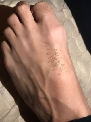 なぜ 足の甲に毛が生えるのでしょうか 何を守ってるので Yahoo 知恵袋