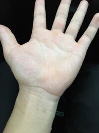 手汗について 素朴な疑問です 世の中のカップルは手を繋ぐ時もあ Yahoo 知恵袋