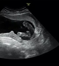 妊娠5ヶ月 28w5d の妊婦です 性別判断をお願いしたいで Yahoo 知恵袋