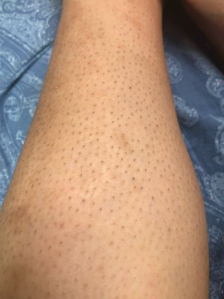 陰毛　薄い　中学生 