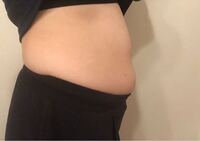 大学生です このお腹は異常な太り方ですよね 前から見るとわり Yahoo 知恵袋