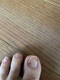 爪が白く濁っていて気になったので白い部分を爪切りで切ったら茶 Yahoo 知恵袋