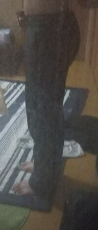 コンプレックスについて 僕は昔太っていてダイエットをして痩せ Yahoo 知恵袋