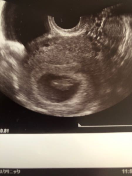 ラムジーメソッドわかる方いますか ラムジーメソッドというのがある Yahoo 知恵袋