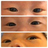 赤ちゃんの目についてです よく 最初は一重だったのがある日二重になった Yahoo 知恵袋
