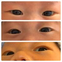生後3ヶ月 普段は腫れぼったい一重だけど薄目の時こんなまぶたになる子って Yahoo 知恵袋 生後3ヶ月 普段は腫れぼったい一重だけど薄目の時こんなまぶたになる子って Yahoo 知恵袋