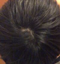 頭乾かしてつむじ見てみたらこんな感じになっていました まだ高校生な Yahoo 知恵袋