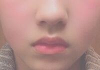 私は 人中 鼻の下の溝 がすごく深いです メイクで隠す Yahoo 知恵袋
