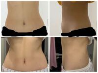 ビフォーアフターです 変わってますか もっとしぼるべ Yahoo 知恵袋