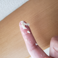 膣の中が痒くて掻いてたら こんなのが出てきました 妊娠中なのです Yahoo 知恵袋