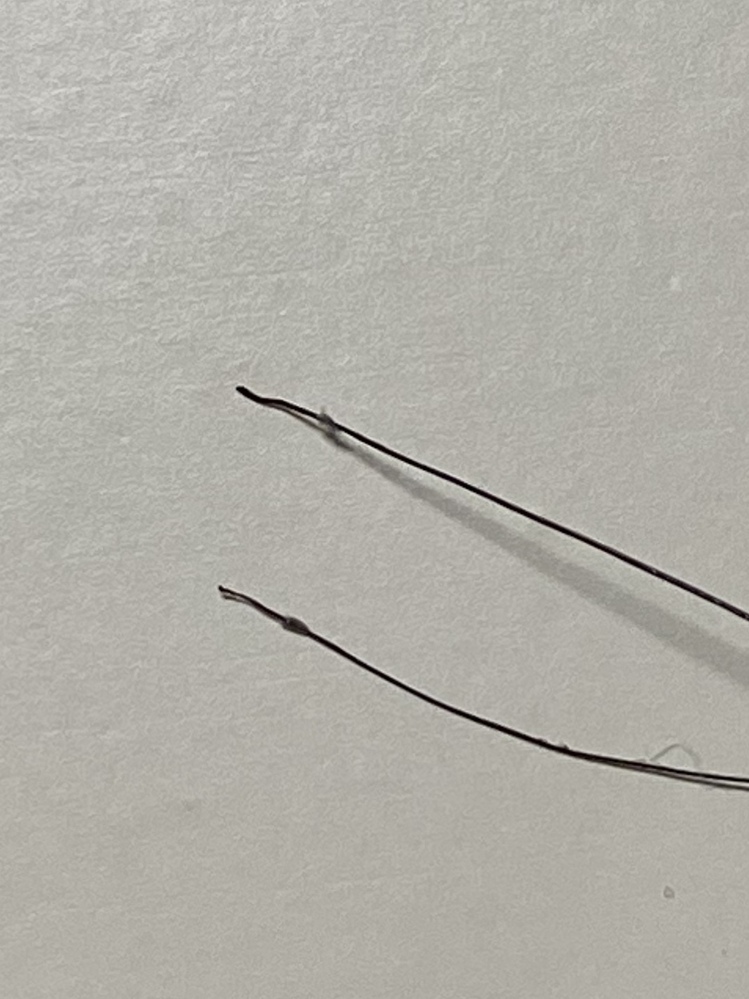 画像付きアホ毛を何本か抜いたところ 毛根に玉のようなものが Yahoo 知恵袋