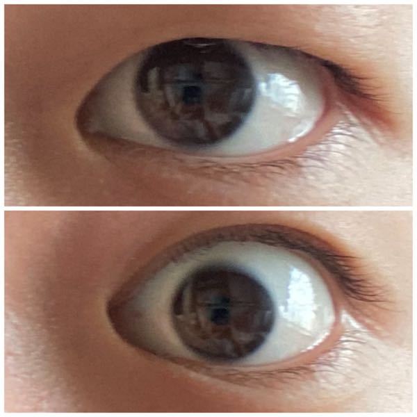 二重にしようと思い 絆創膏を貼るんですが 絆創膏が食い込まずただ貼って Yahoo 知恵袋