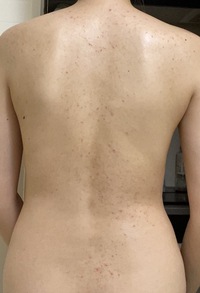 画像付きです 汚い画像になるので 閲覧注意です 21歳の女です 以前か Yahoo 知恵袋