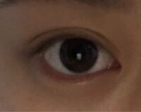 渡韓できるようになったら 目付き矯正 二重切開 目頭切開 小鼻収縮をやろうと Yahoo 知恵袋