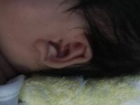 赤ちゃんの生後１ヶ月ですが 右向きに向き癖があり 耳の形がお Yahoo 知恵袋