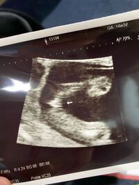 妊娠14週です 今日産婦人科で女の子だと言われたのですが 詳しい Yahoo 知恵袋