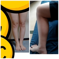 足が太いか 太くないか教えてほしいですダイエットで12キロ痩せましたが Yahoo 知恵袋