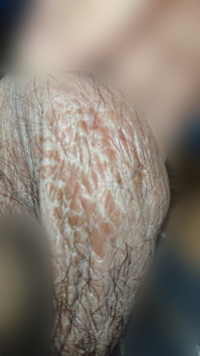 Apictnyohukra 無料ダウンロード 金玉 袋 痛い 金玉 袋 痛い