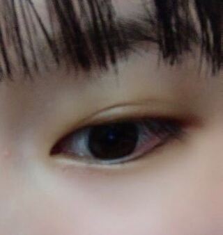化粧を落としても写真ように 目の周りだけ黄ばんでいます 色素 Yahoo 知恵袋