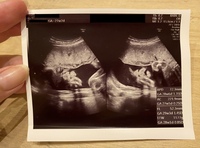 胎児のエコー写真について 添付写真あり 現在妊娠27週の妊婦 Yahoo 知恵袋