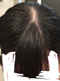 前髪の三角形 を小さくしたいです普通は上の写真のように三角形が広くて 大 Yahoo 知恵袋