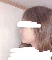 汚い写真ですいません高校生女子です 昔から頬肉が分厚く顔がパンパンで大きいこ Yahoo 知恵袋