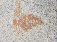 コンクリートについた錆び 汚れの取り方わかりますか 鉄板をひいたらなりました 教えて 住まいの先生 Yahoo 不動産