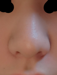 鼻クリップや洗濯バサミをずっと一日中挟んでいるとそのうち鼻の大きさが Yahoo 知恵袋