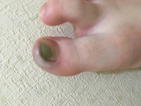 ネイルしてないのにグリーンネイル になってしまいました それともこれは Yahoo 知恵袋