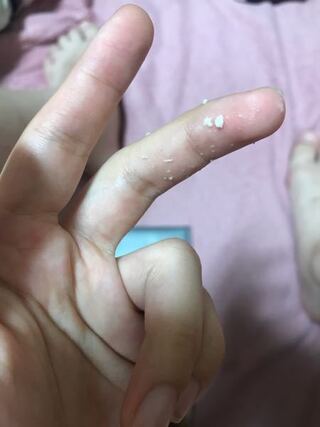 無料でダウンロード 卵白 の よう な オリモノ